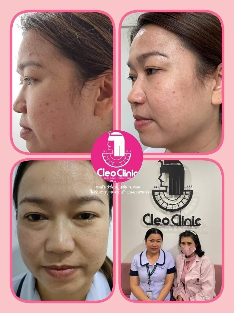 รีวิว ปี 62