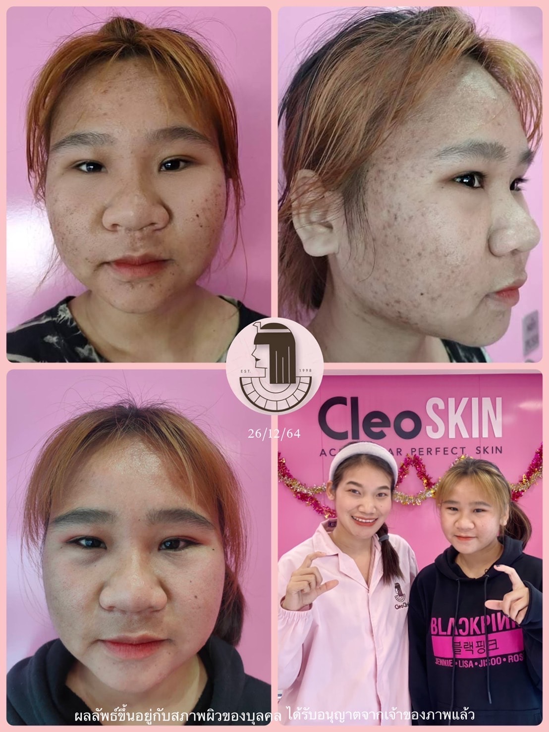 รีวิว ปี 62