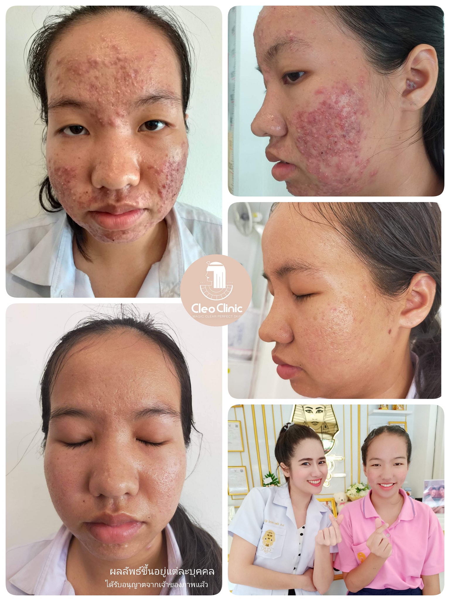 รีวิว ปี 62