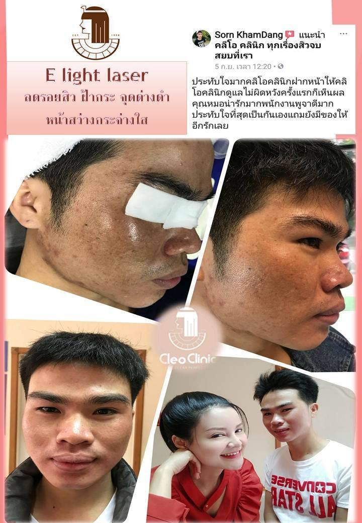 รีวิว ปี 62