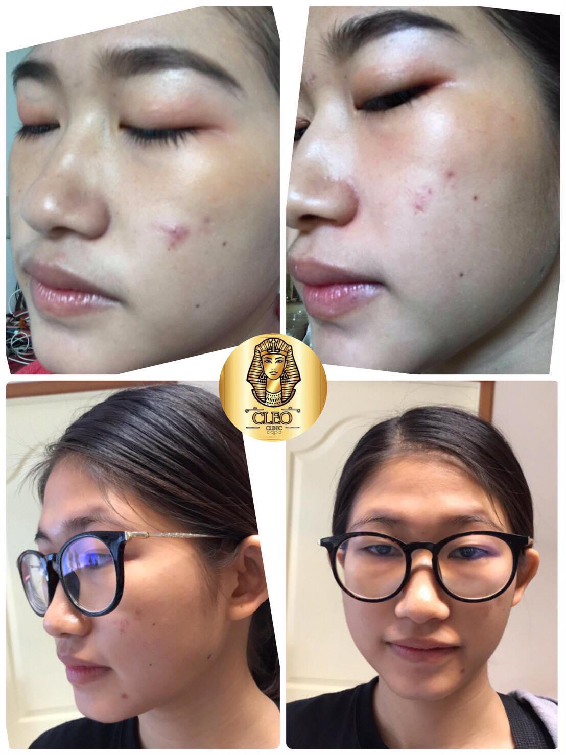 รีวิว ปี 62