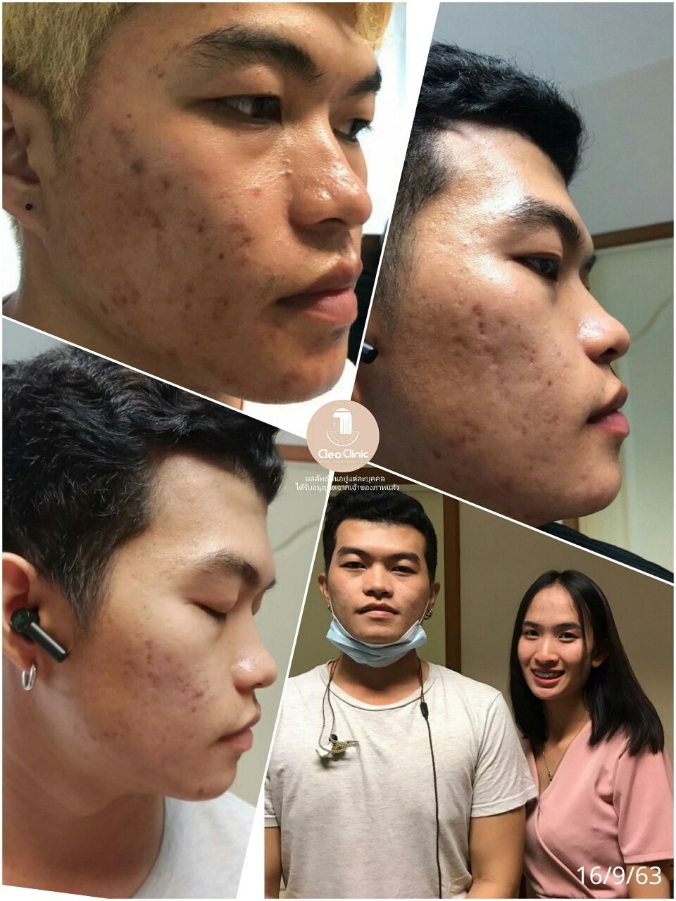 รีวิว ปี 62