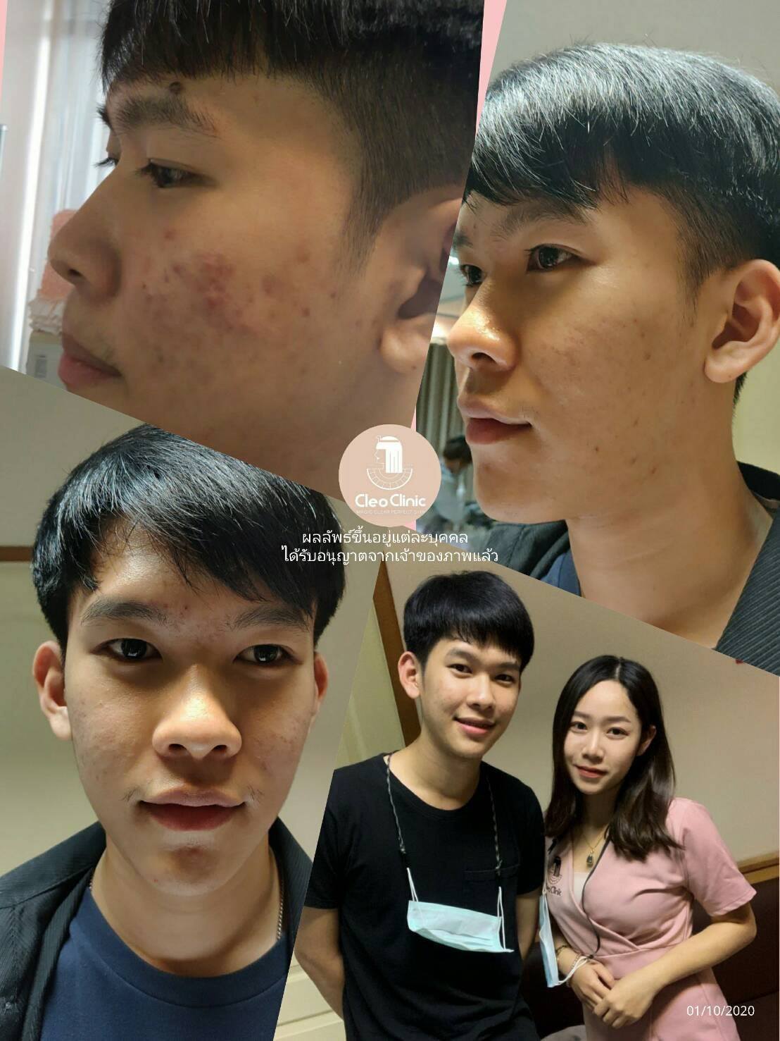 รีวิว ปี 62