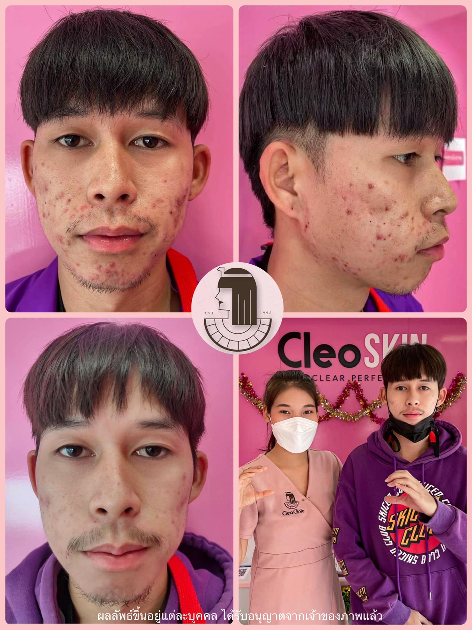 รีวิว ปี 62