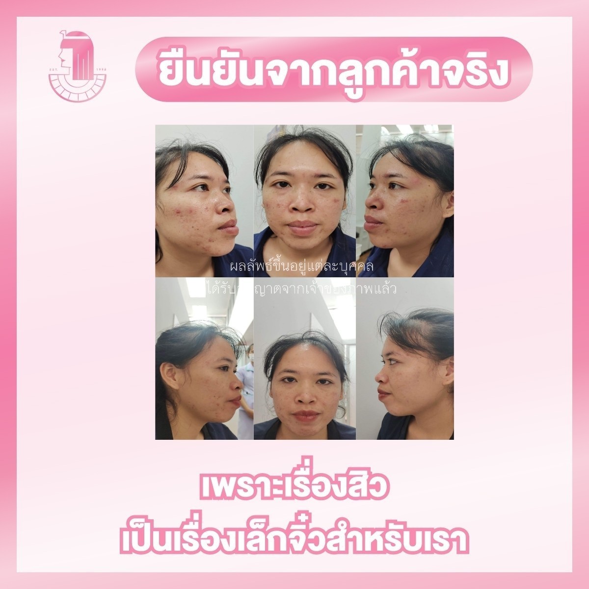 รีวิว ปี 62