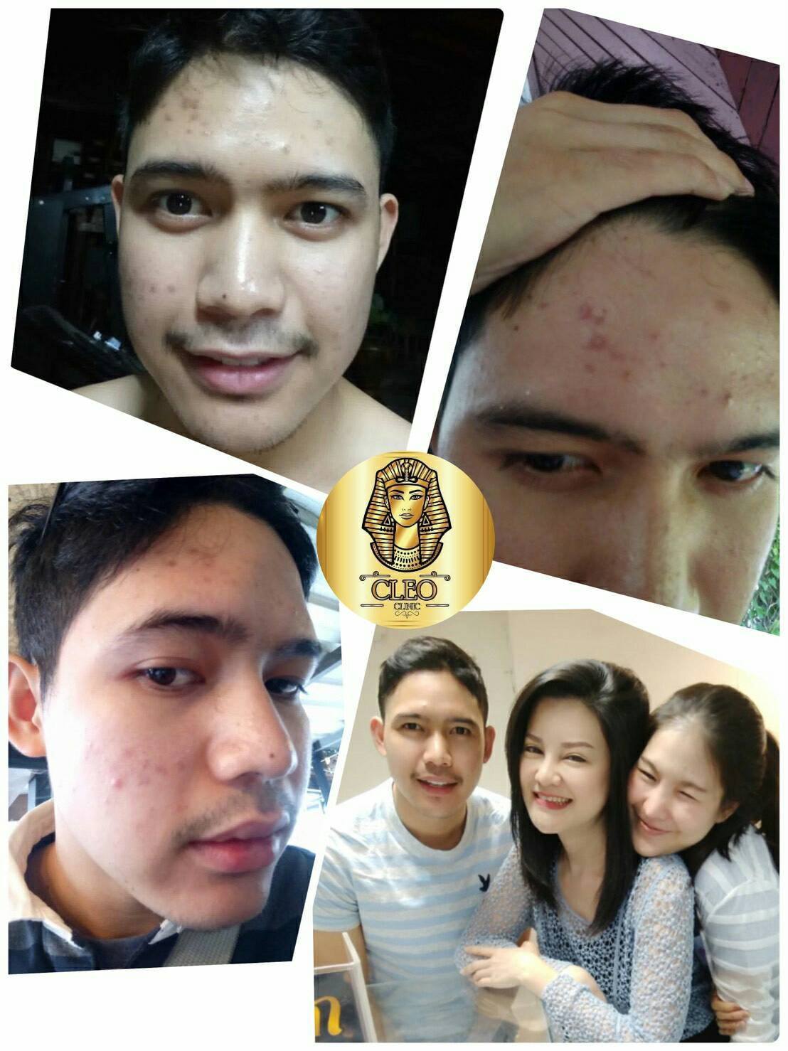 รีวิว ปี 62