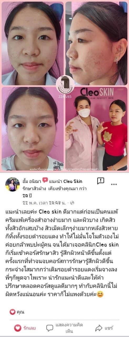 รีวิว ปี 62