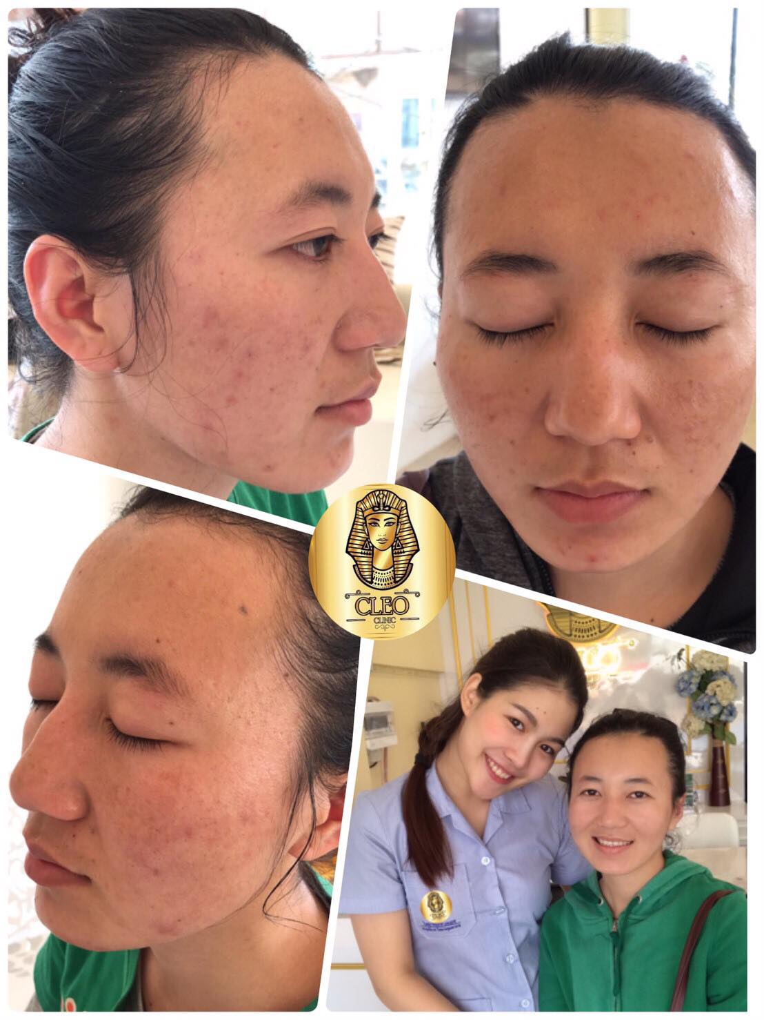 รีวิว ปี 62