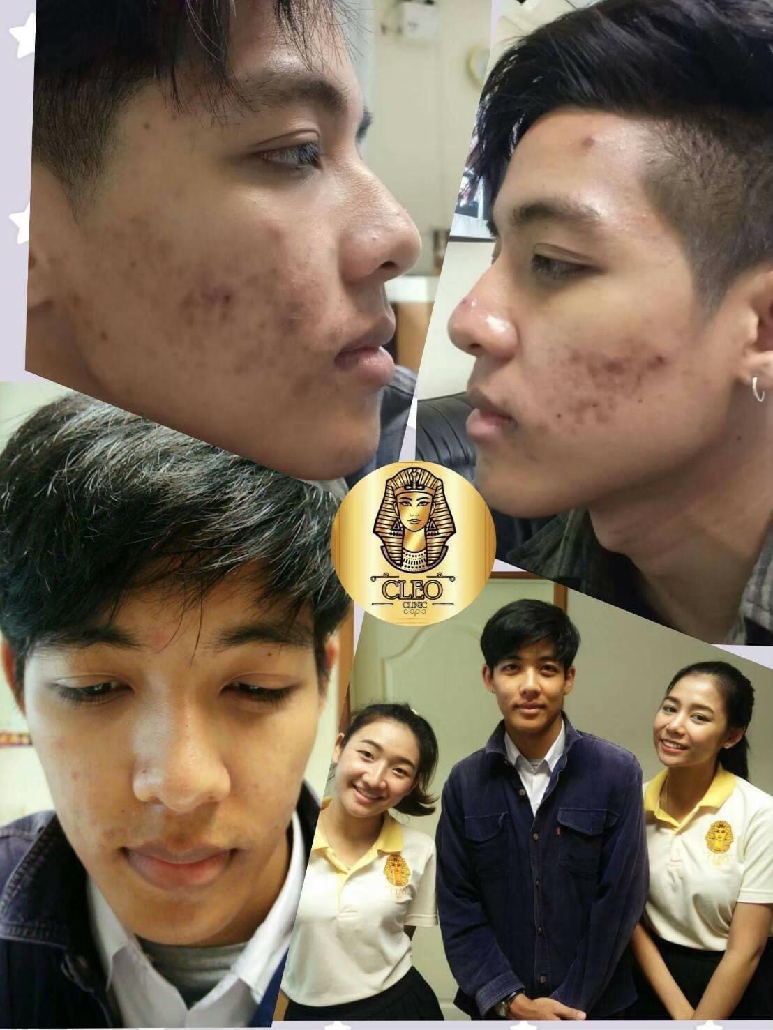 รีวิว ปี 62