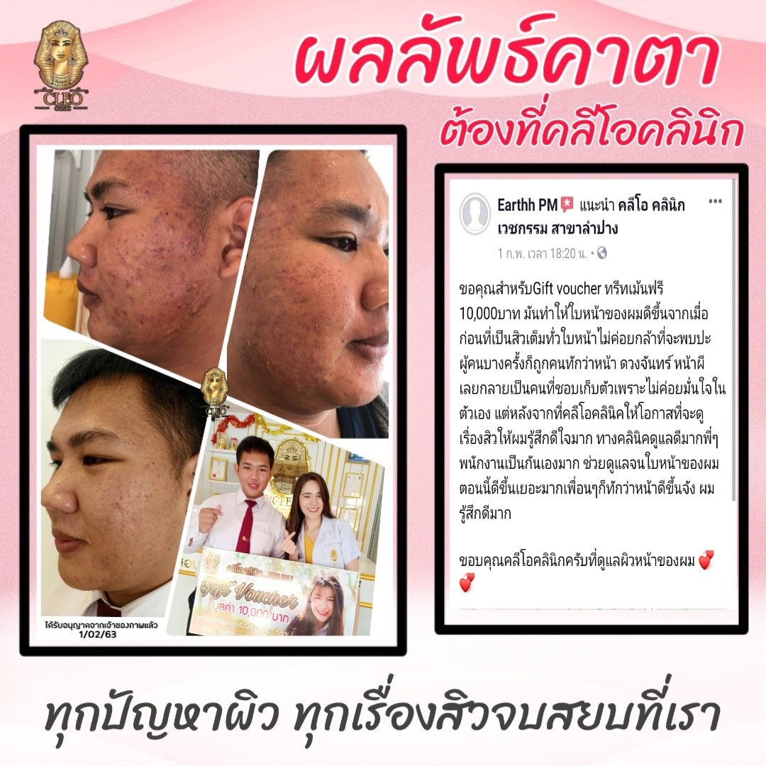 รีวิว ปี 62