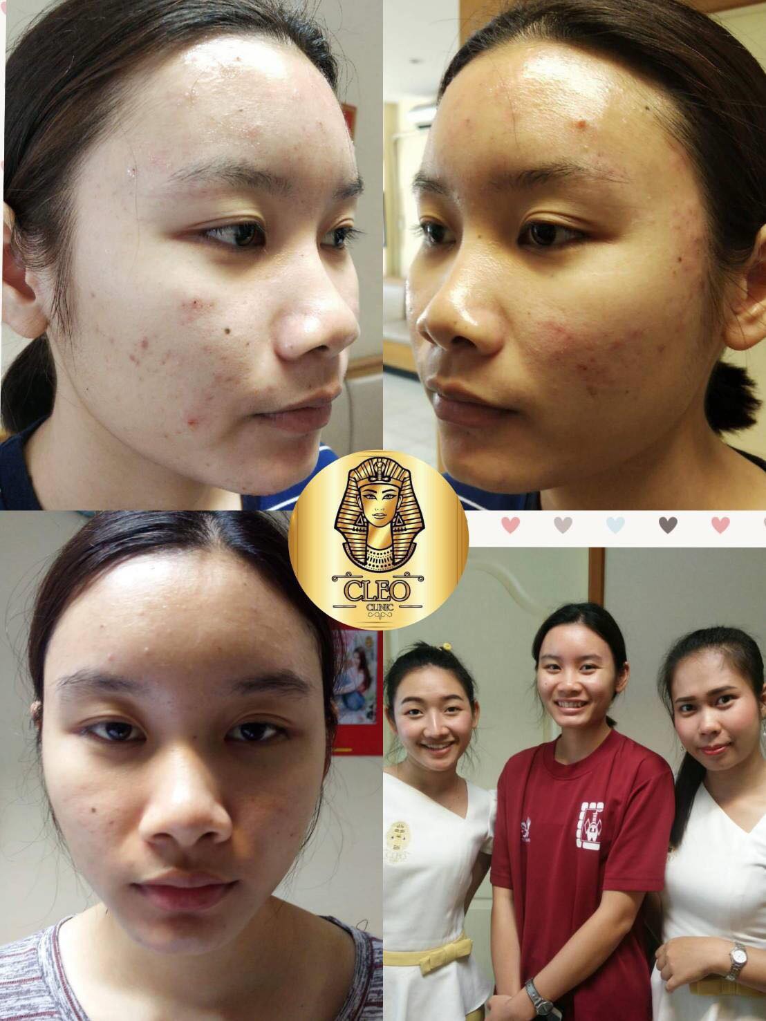 รีวิว ปี 62