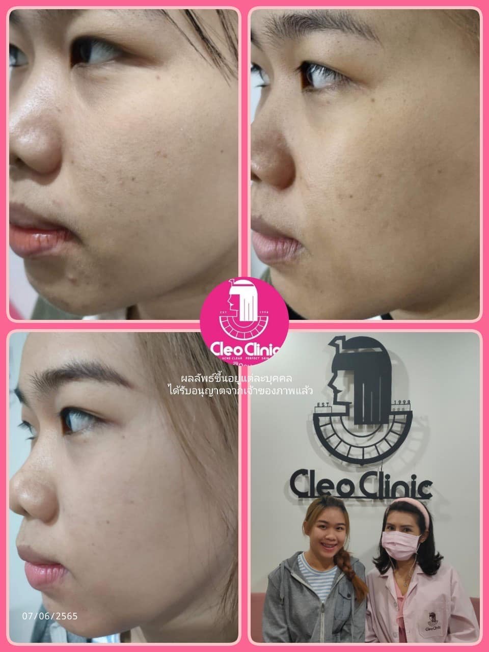 รีวิว ปี 62