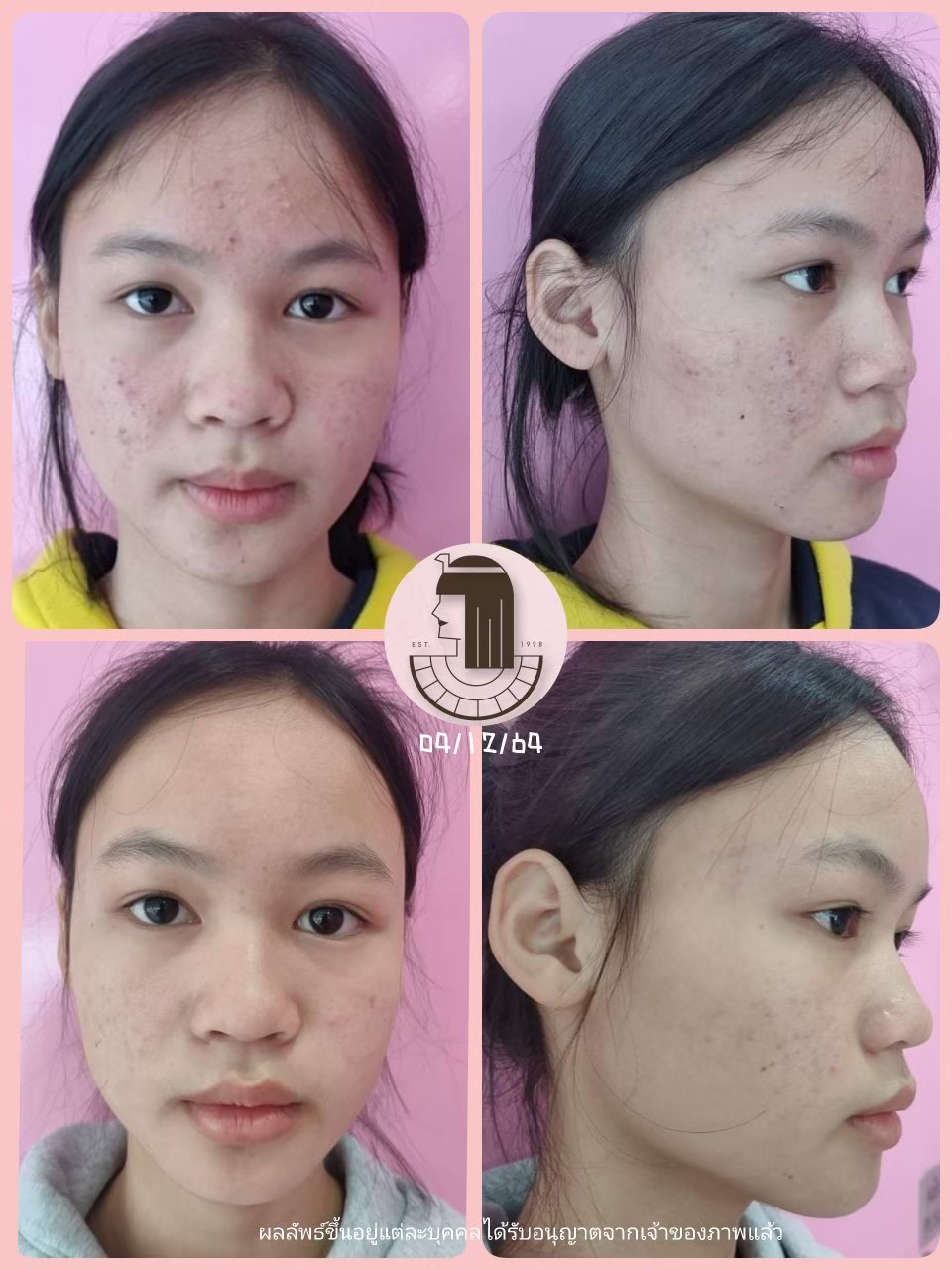 รีวิว ปี 62