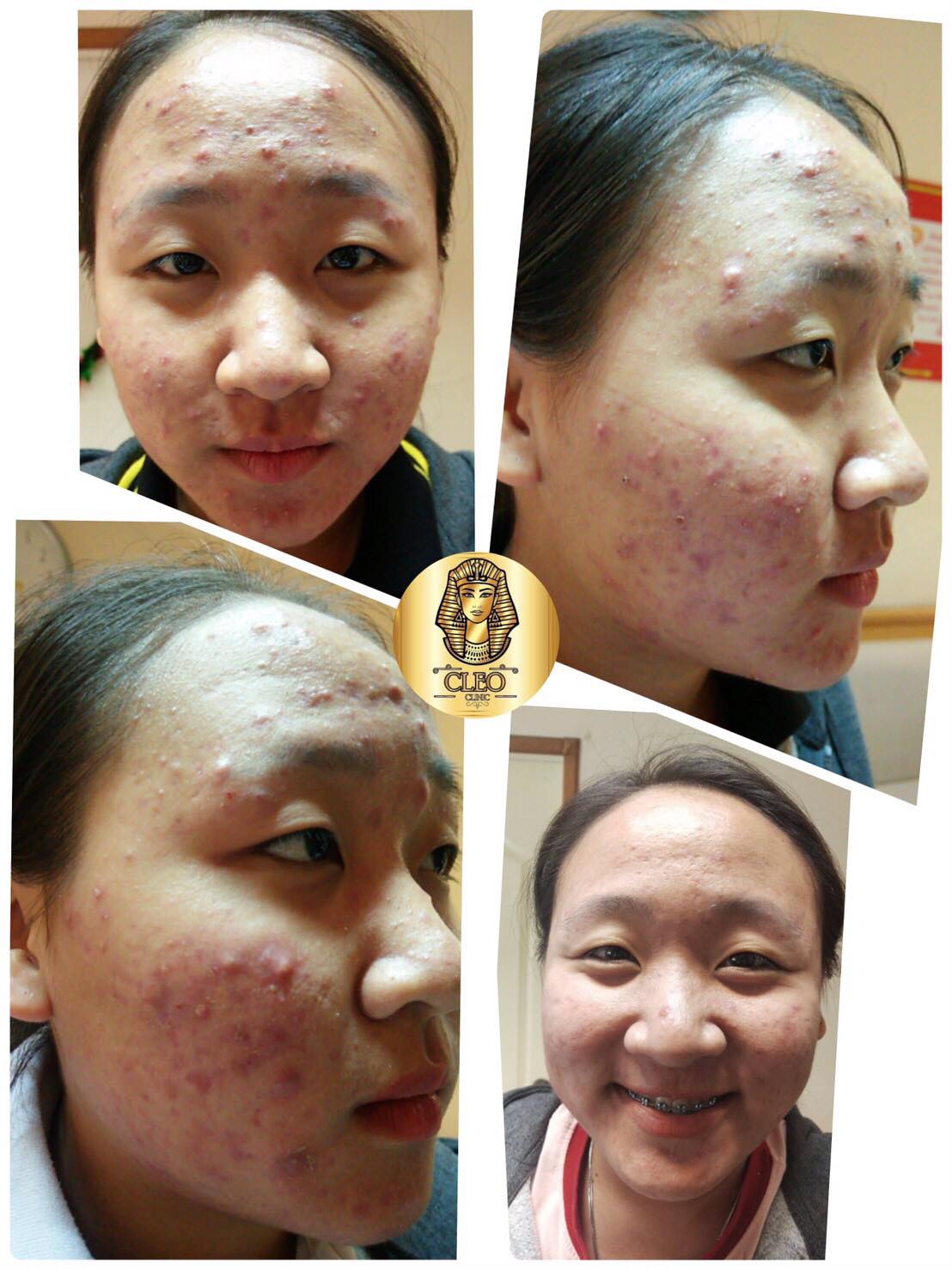 รีวิว ปี 62