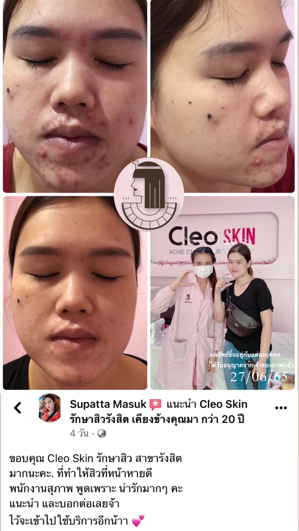 รีวิว ปี 62