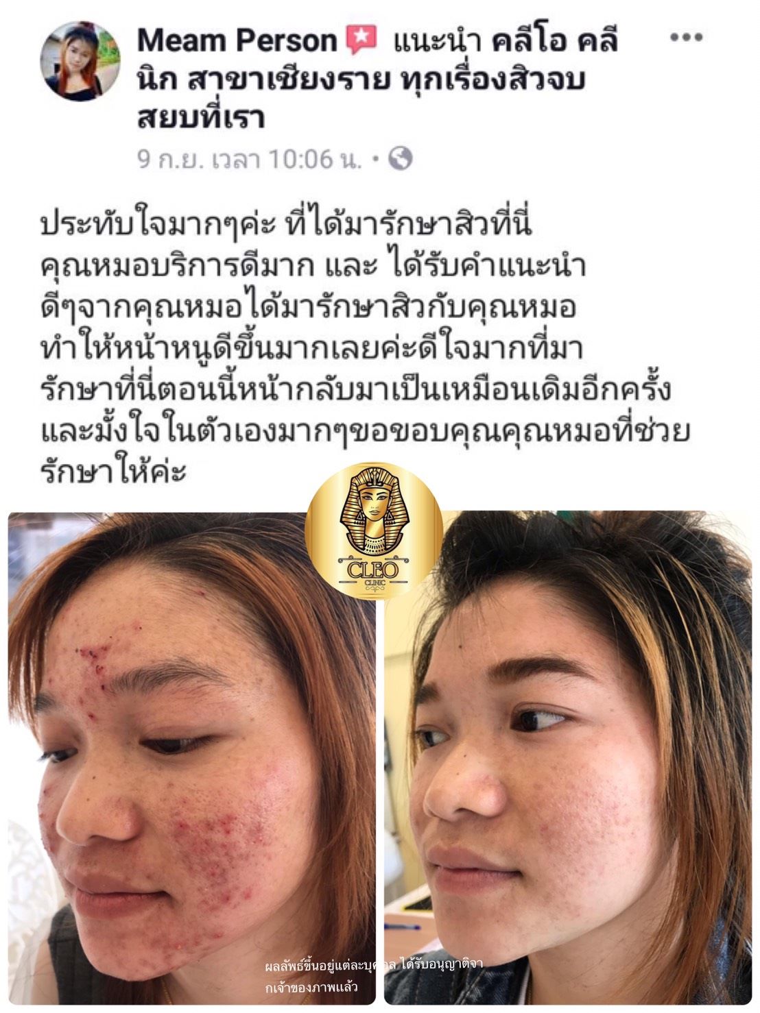 รีวิว ปี 62