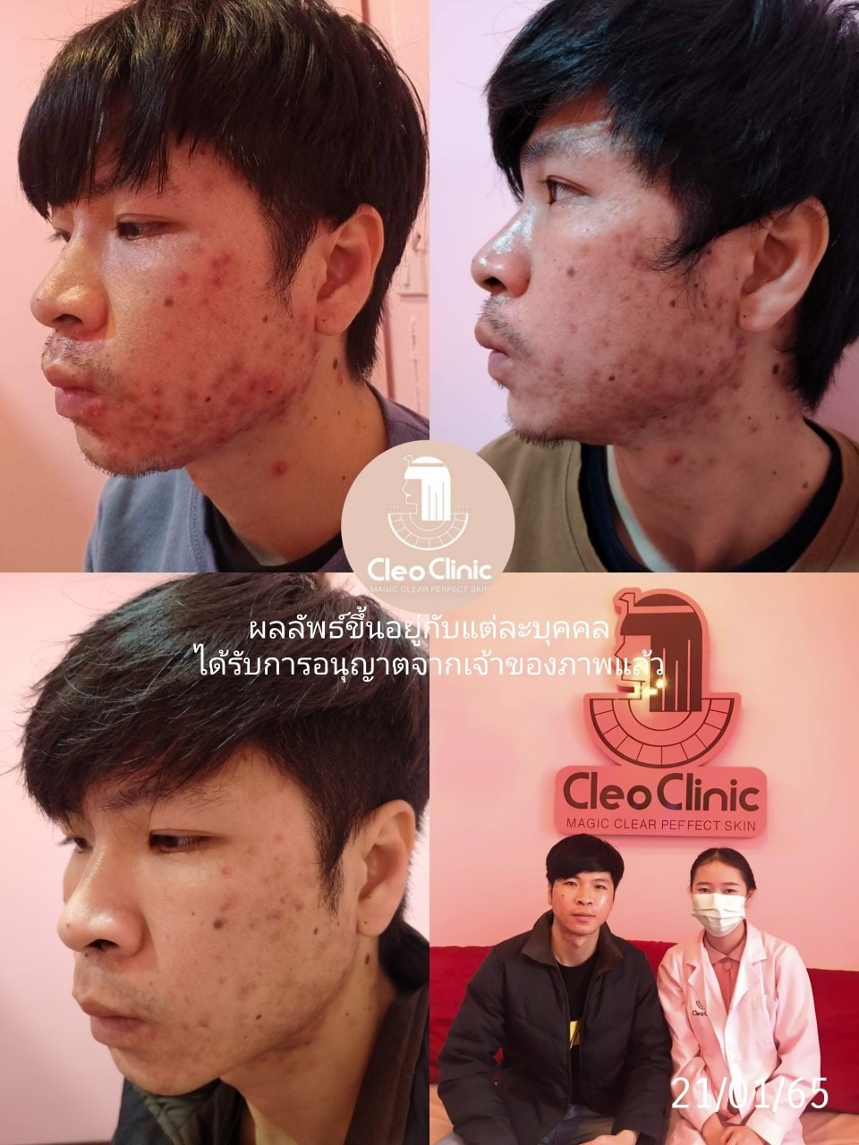 รีวิว ปี 62