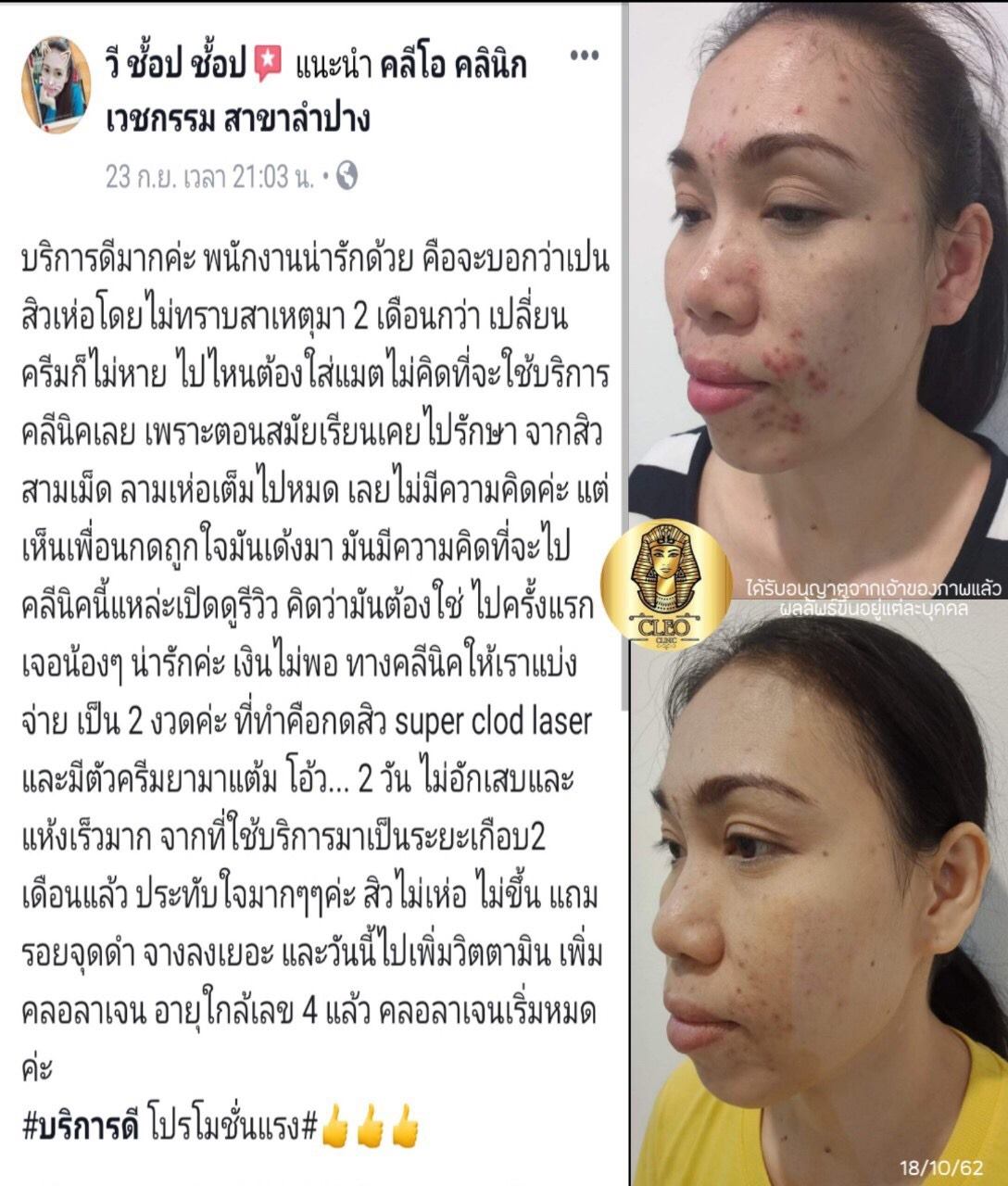 รีวิว ปี 62