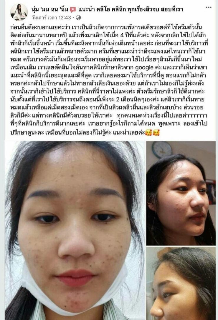 รีวิว ปี 62