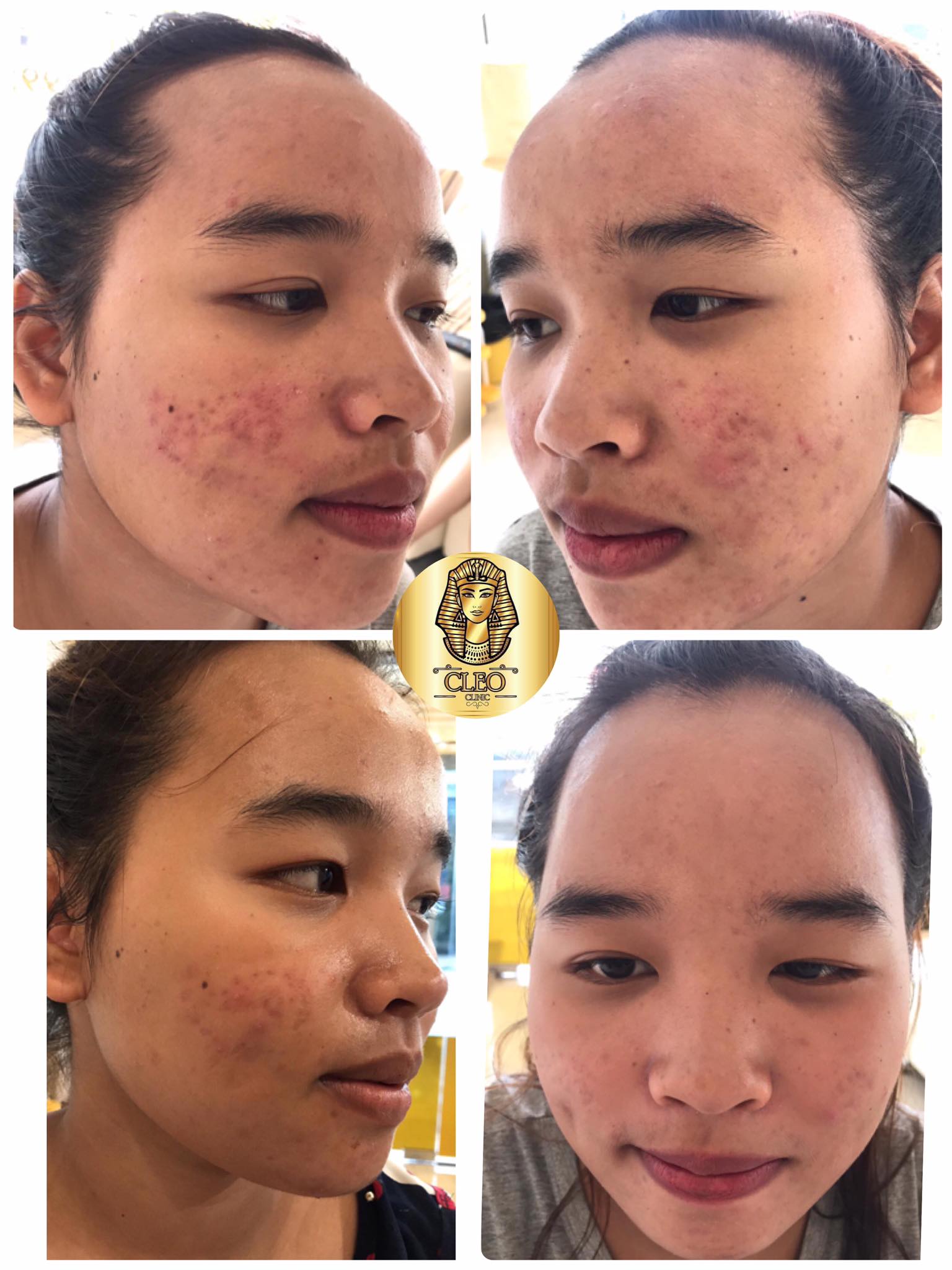 รีวิว ปี 62