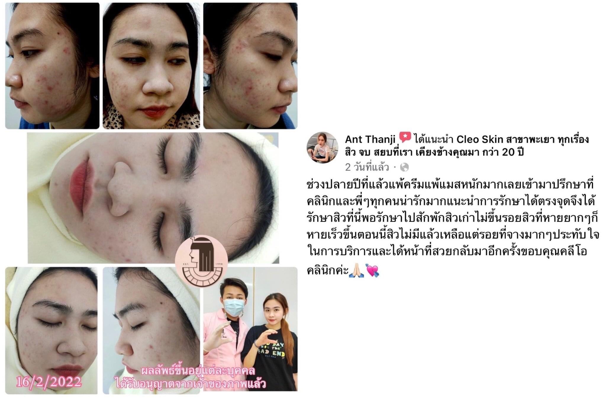 รีวิว ปี 62