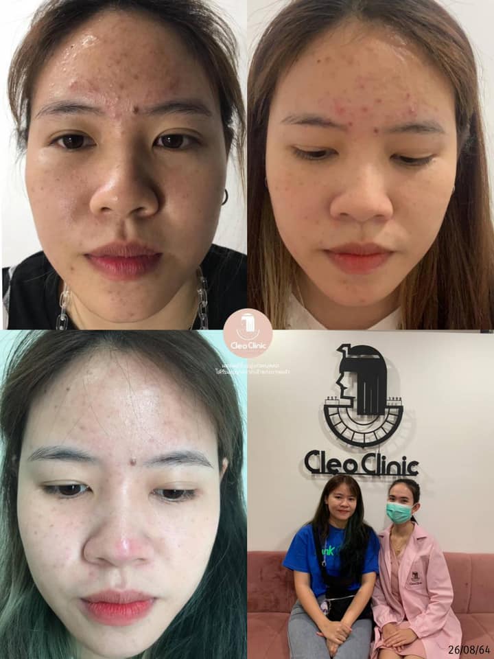 รีวิว ปี 62