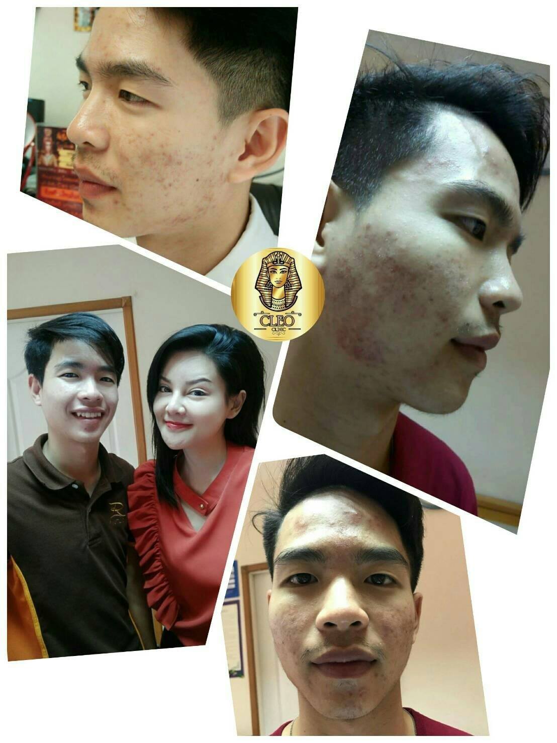 รีวิว ปี 62