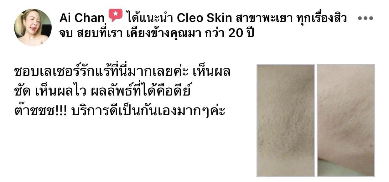 รีวิว ปี 62