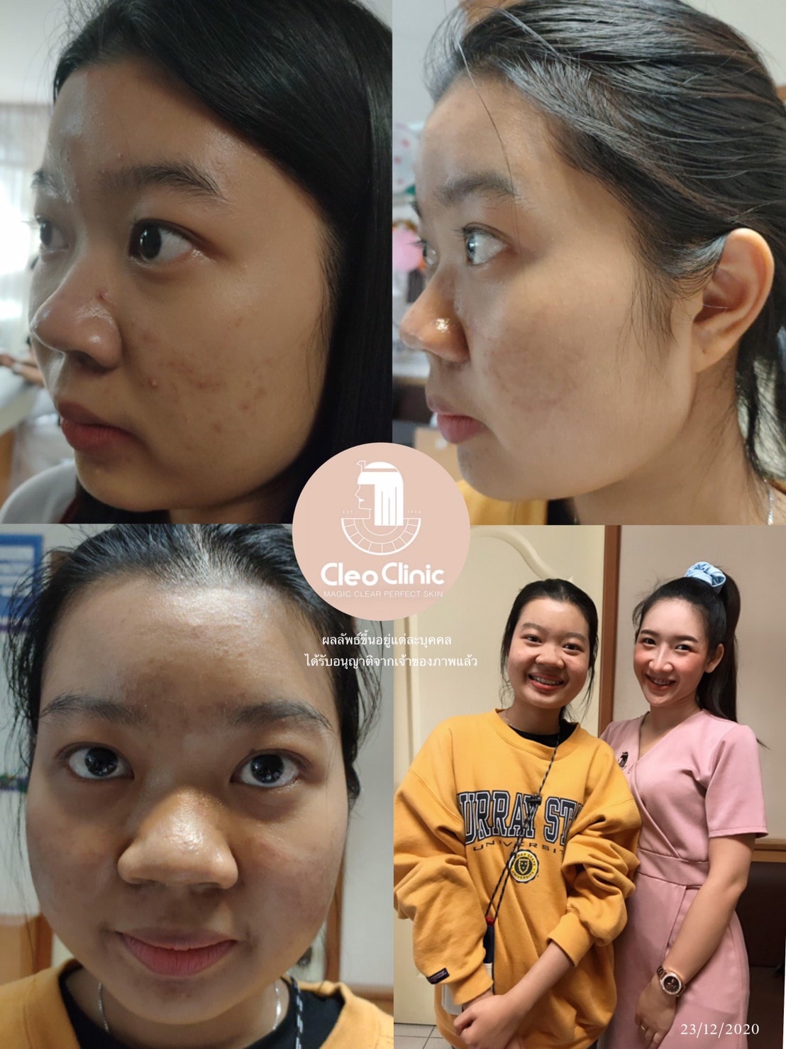 รีวิว ปี 62