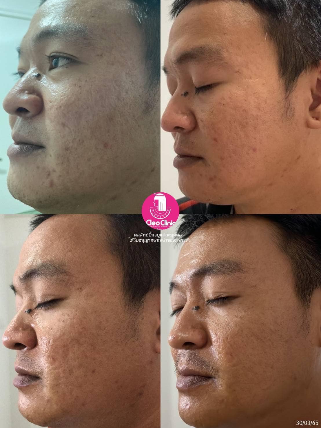 รีวิว ปี 62