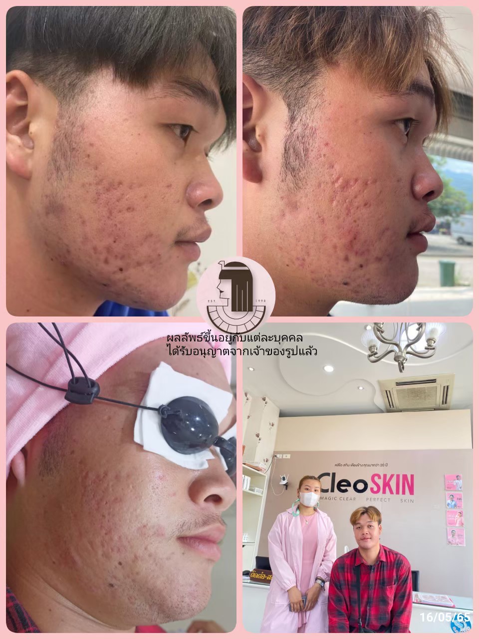 รีวิว ปี 62