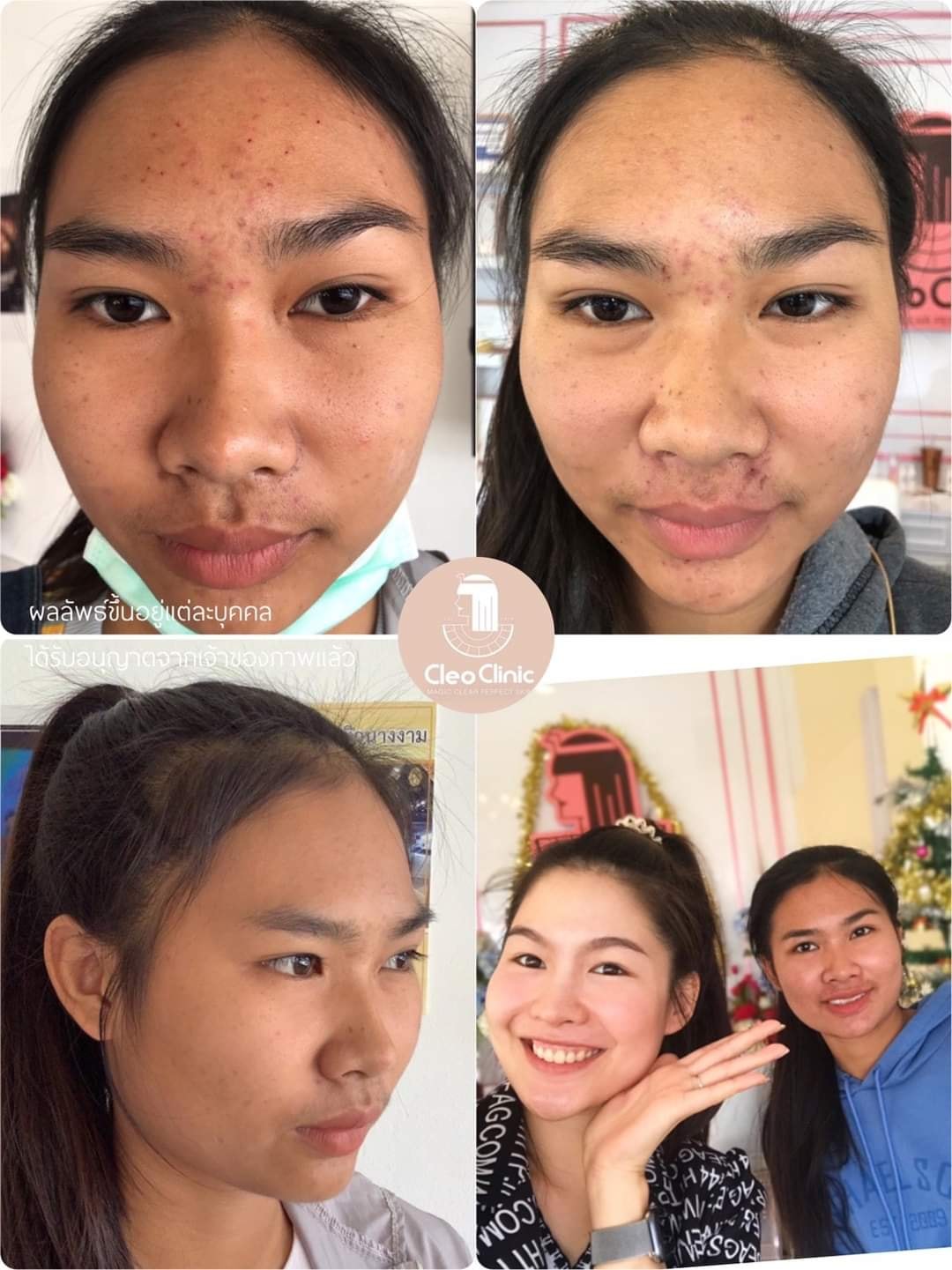 รีวิว ปี 62