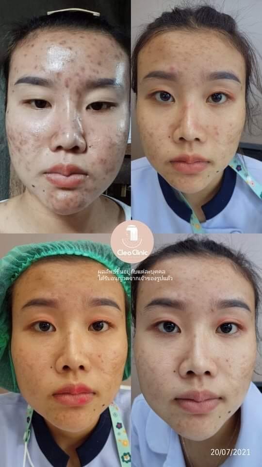 รีวิว ปี 62