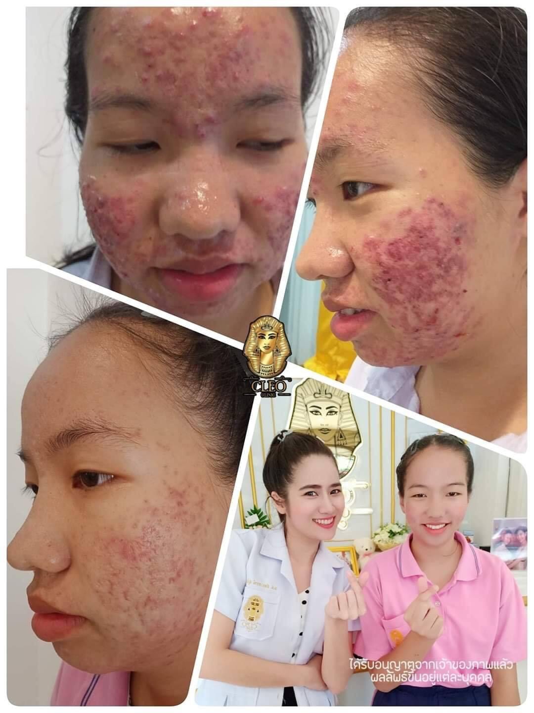 รีวิว ปี 62