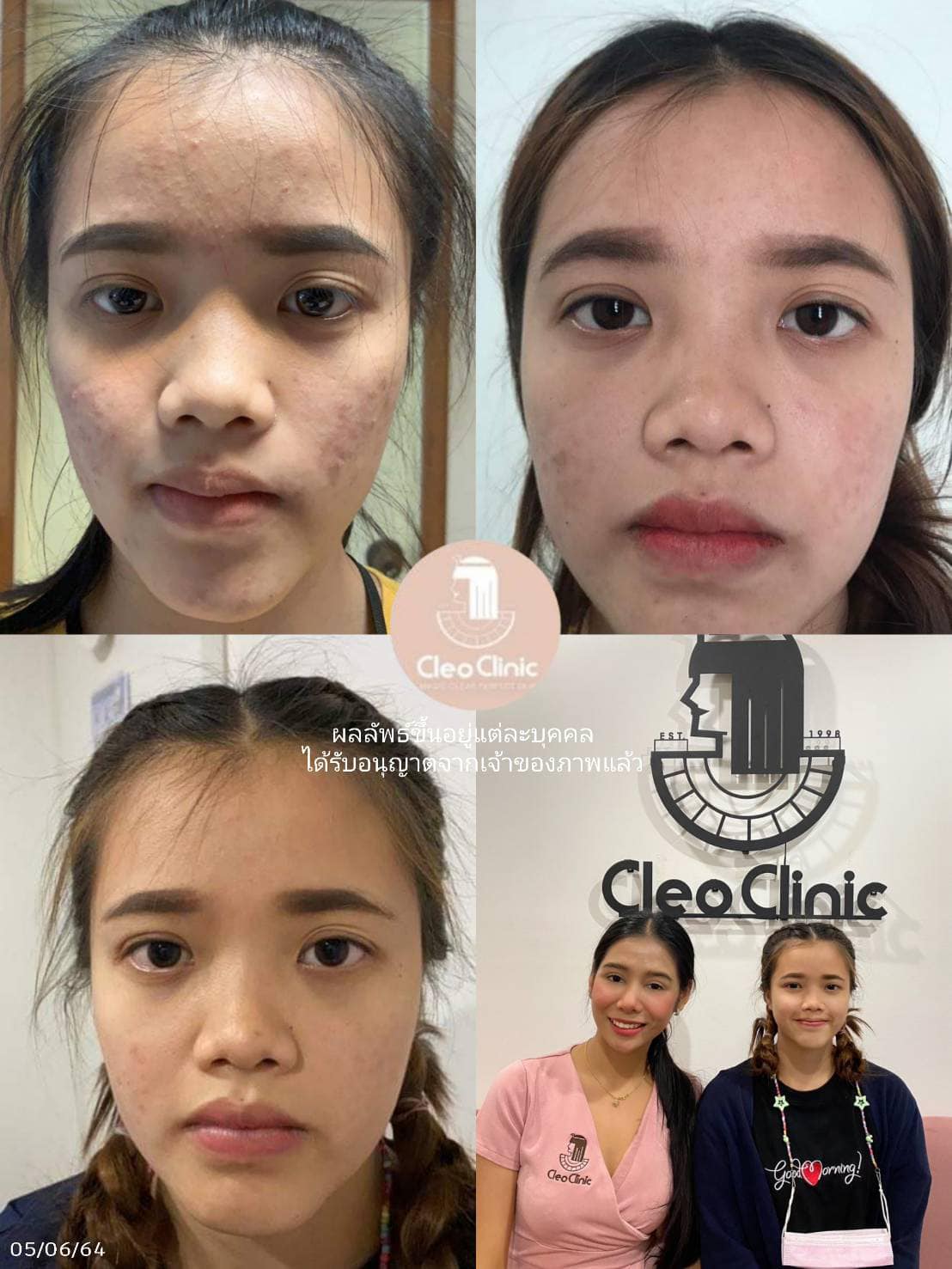 รีวิว ปี 62