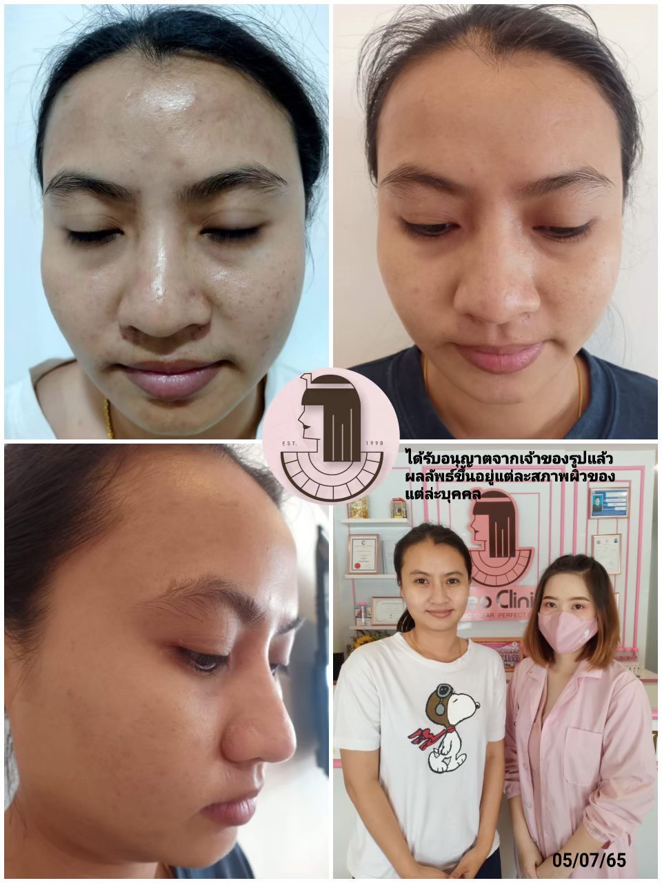 รีวิว ปี 62