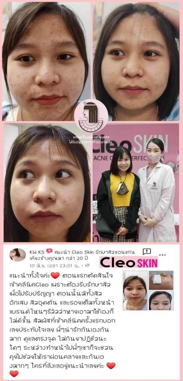 รีวิว ปี 62