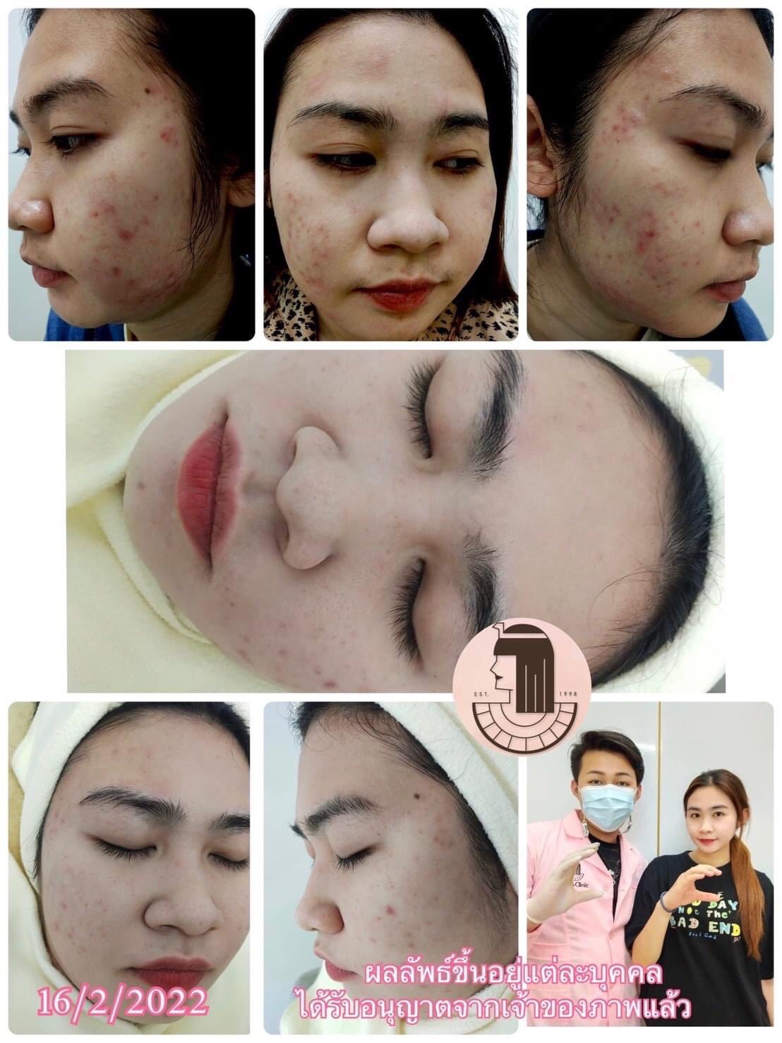 รีวิว ปี 62