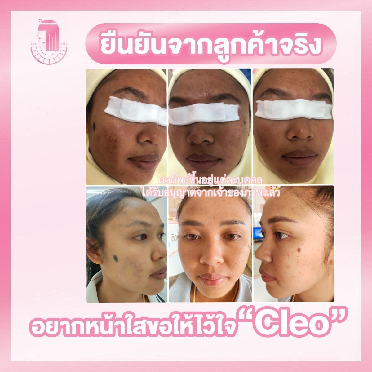 รีวิว ปี 62