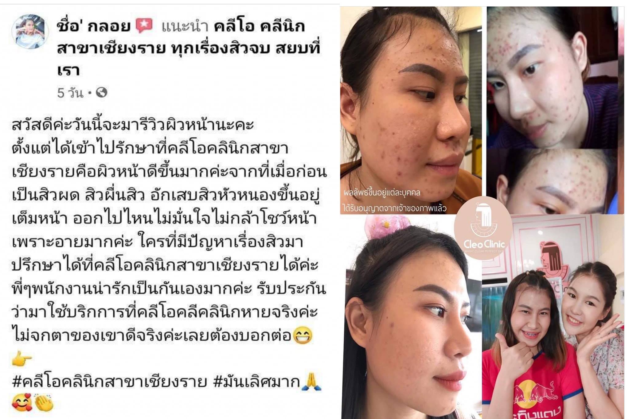 รีวิว ปี 62