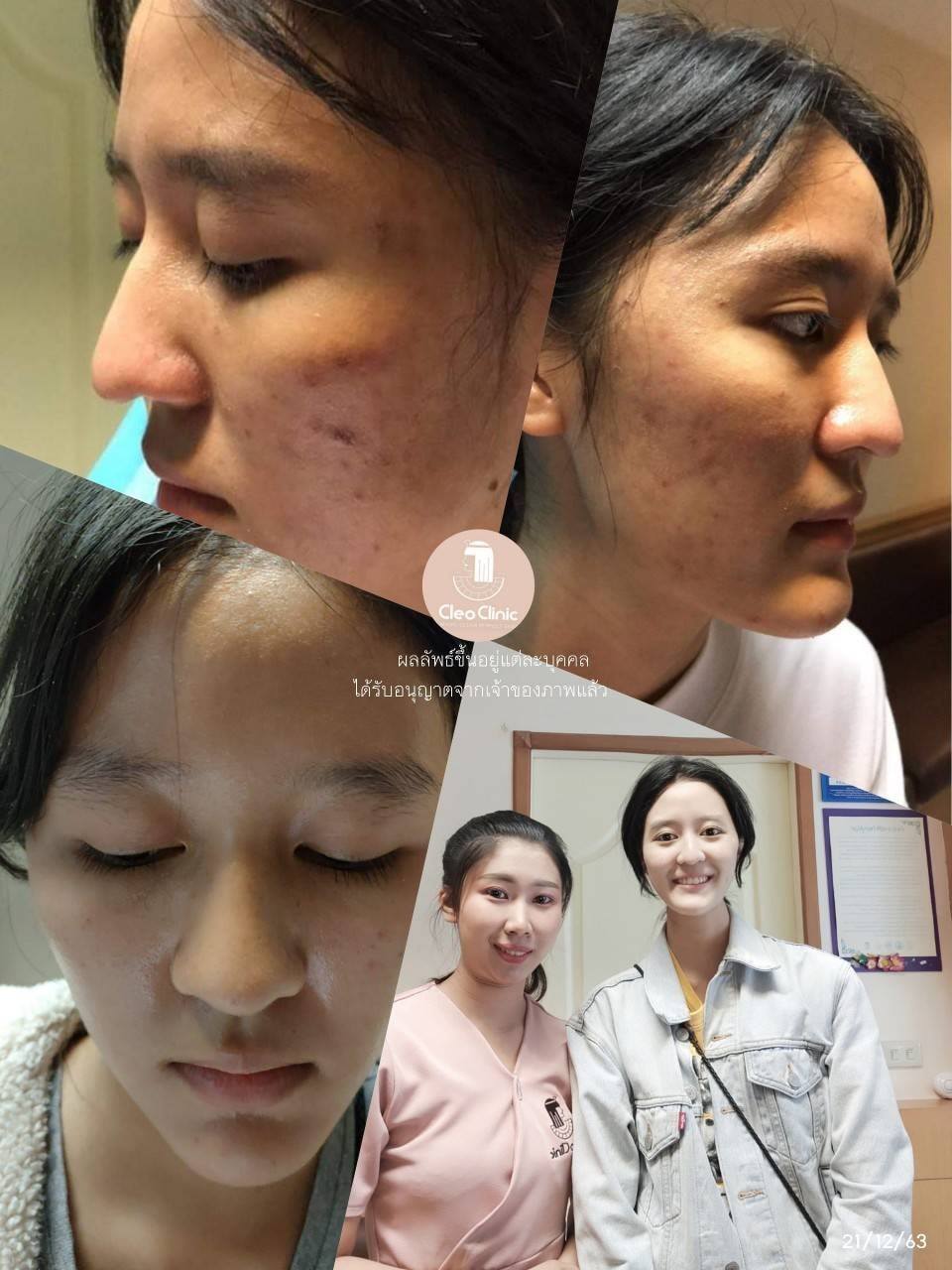 รีวิว ปี 62