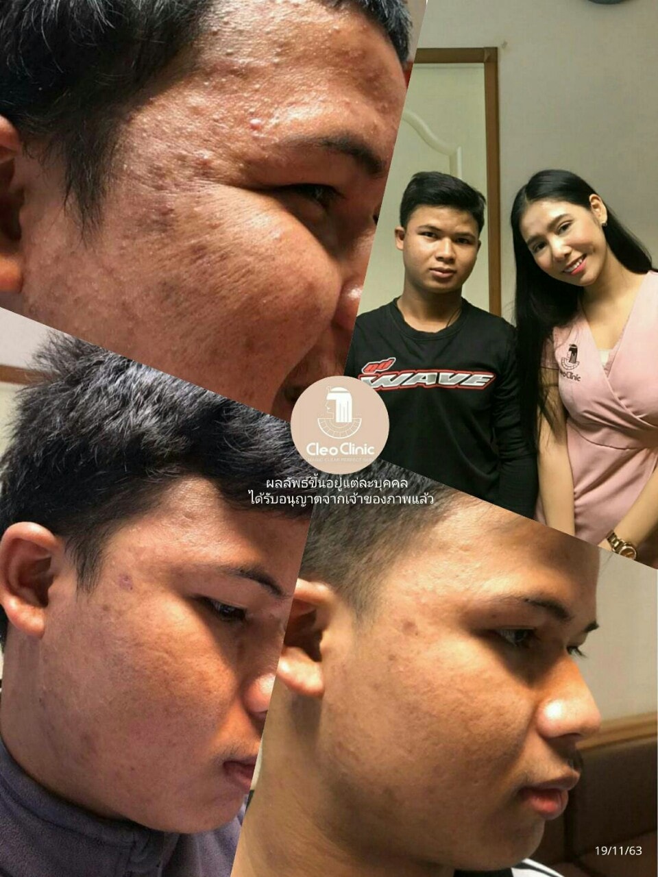 รีวิว ปี 62