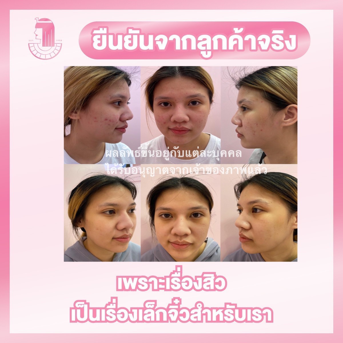 รีวิว ปี 62