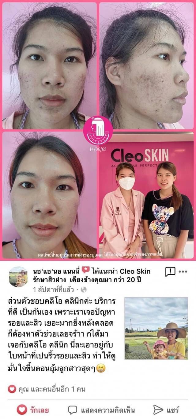 รีวิว ปี 62