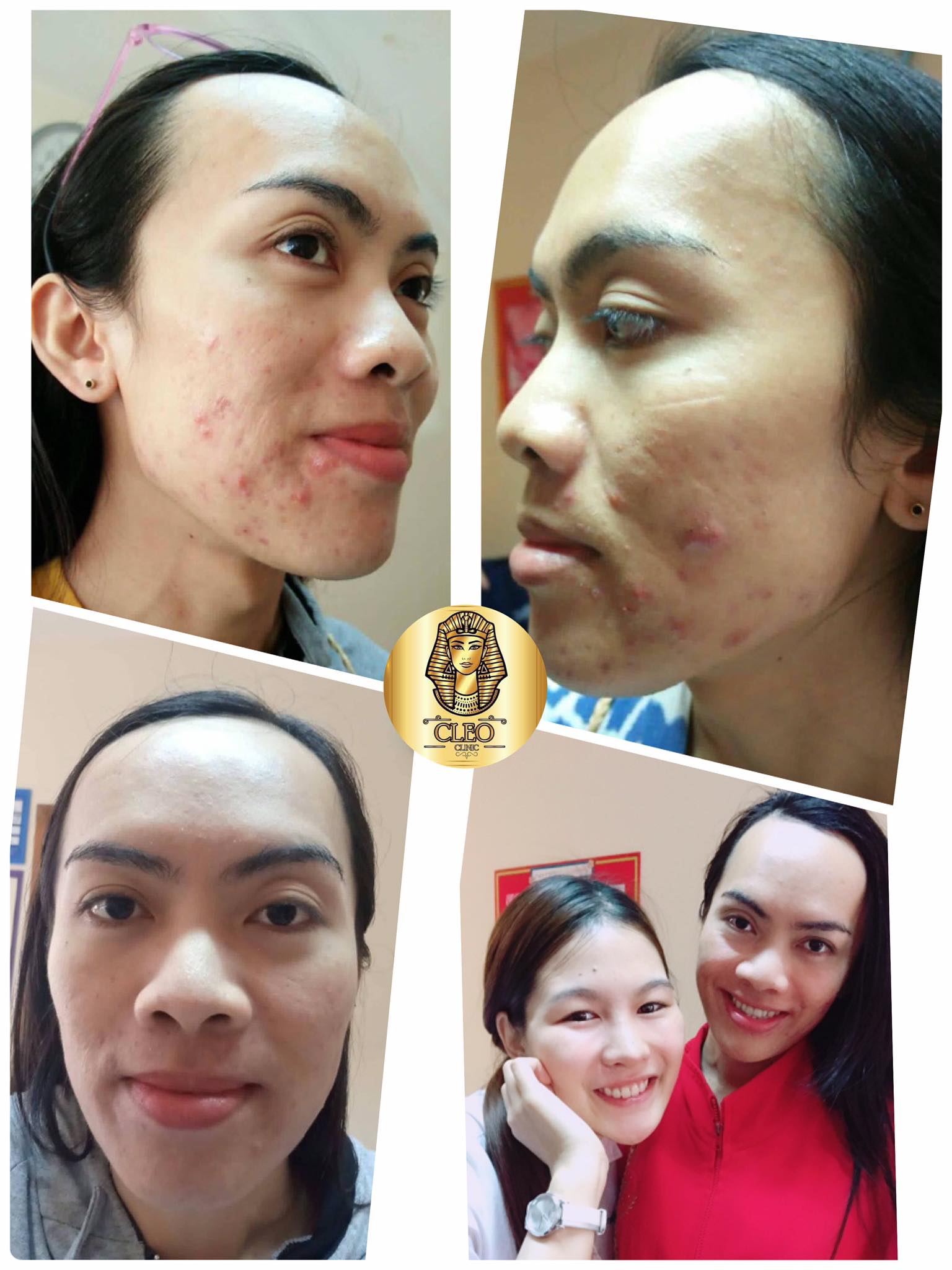 รีวิว ปี 62