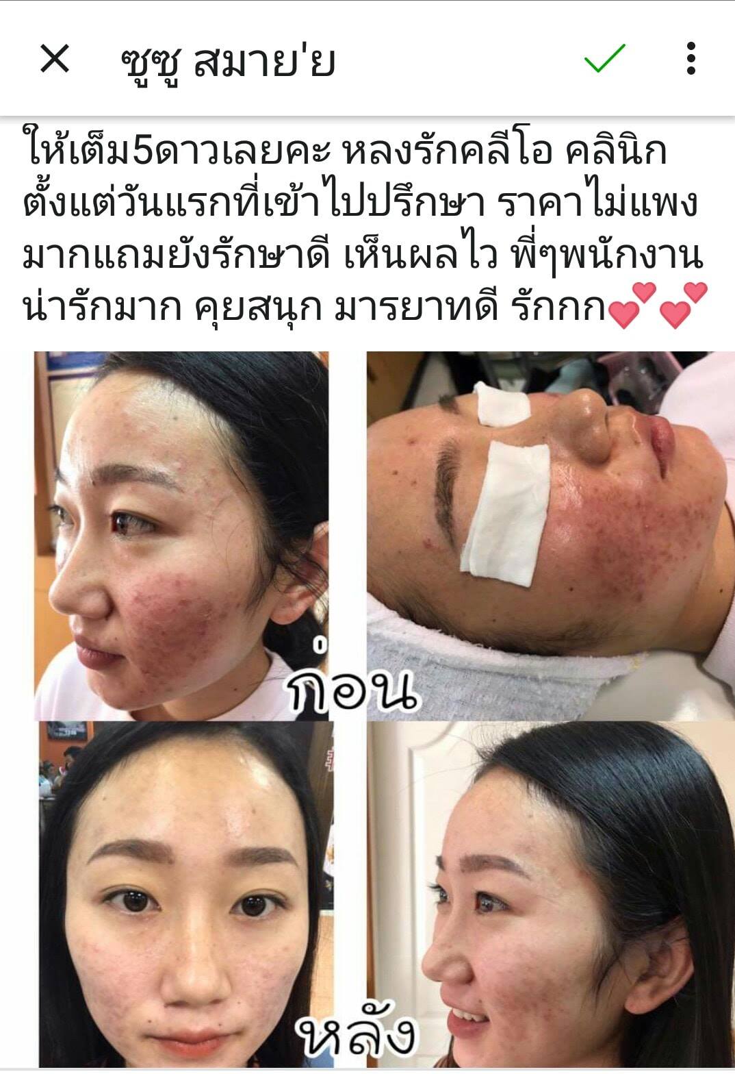 รีวิว ปี 62