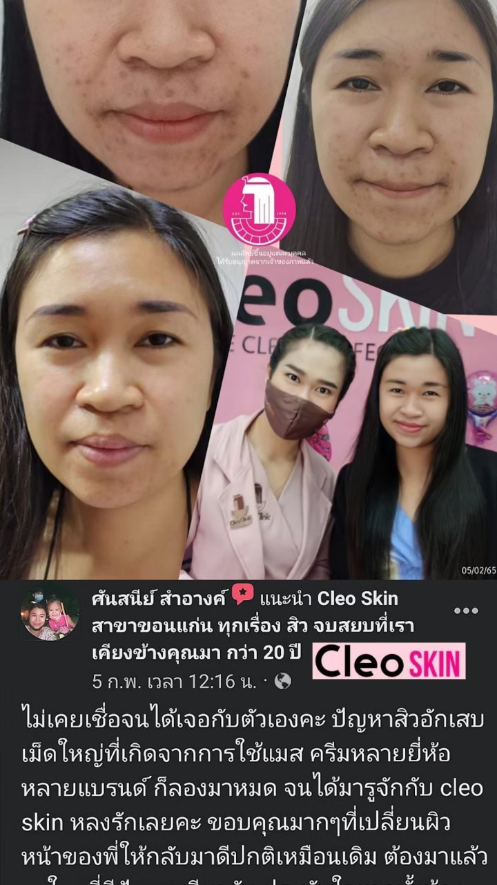 รีวิว ปี 62