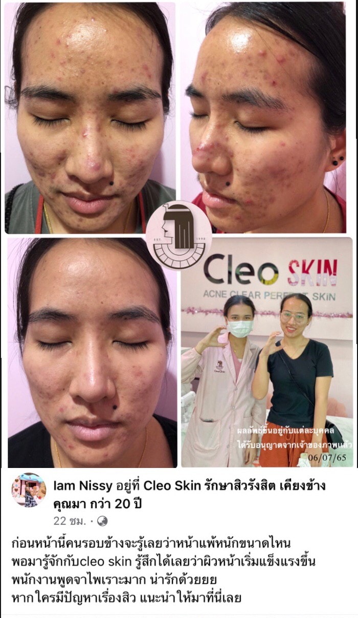 รีวิว ปี 62