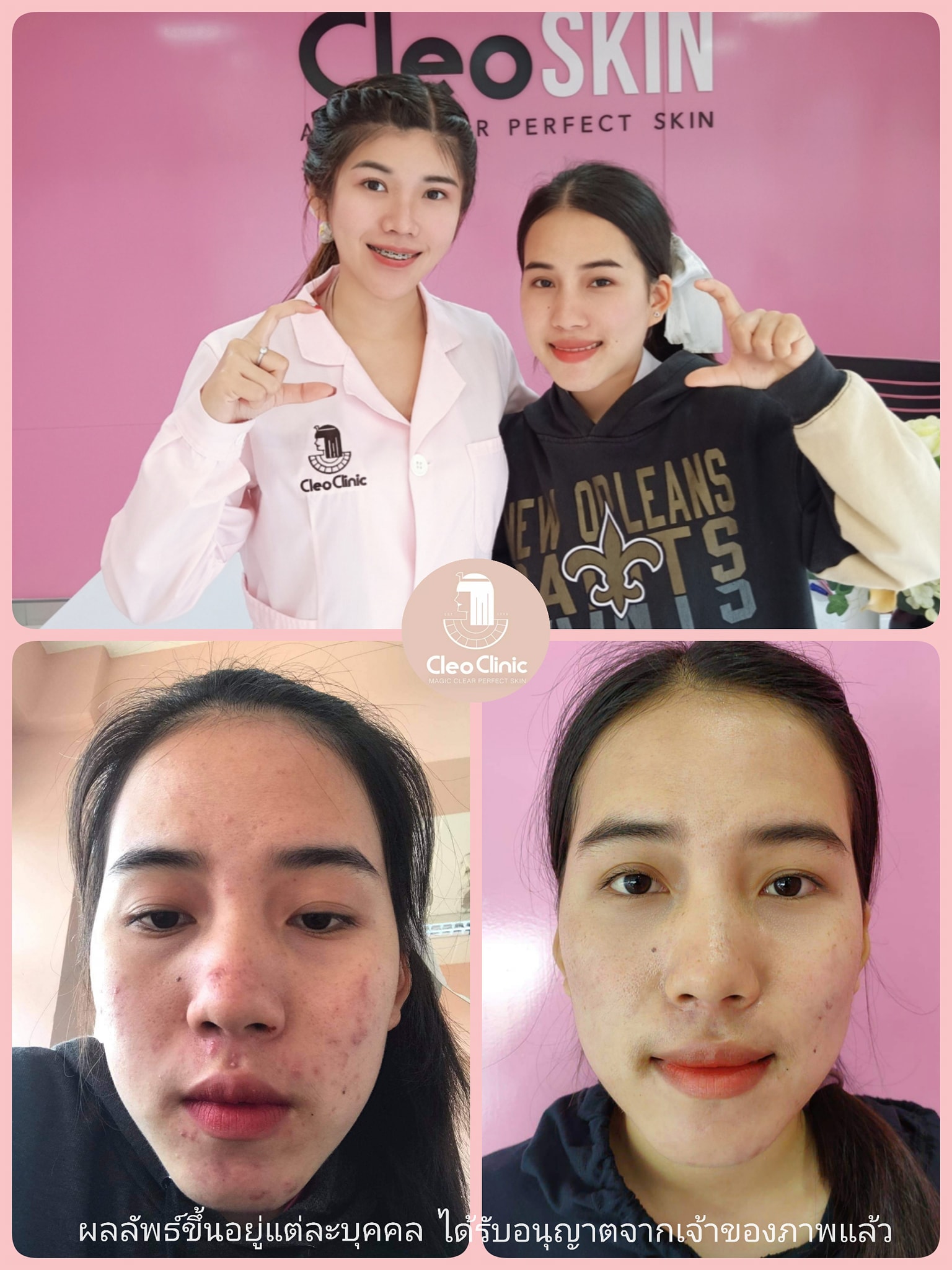 รีวิว ปี 62