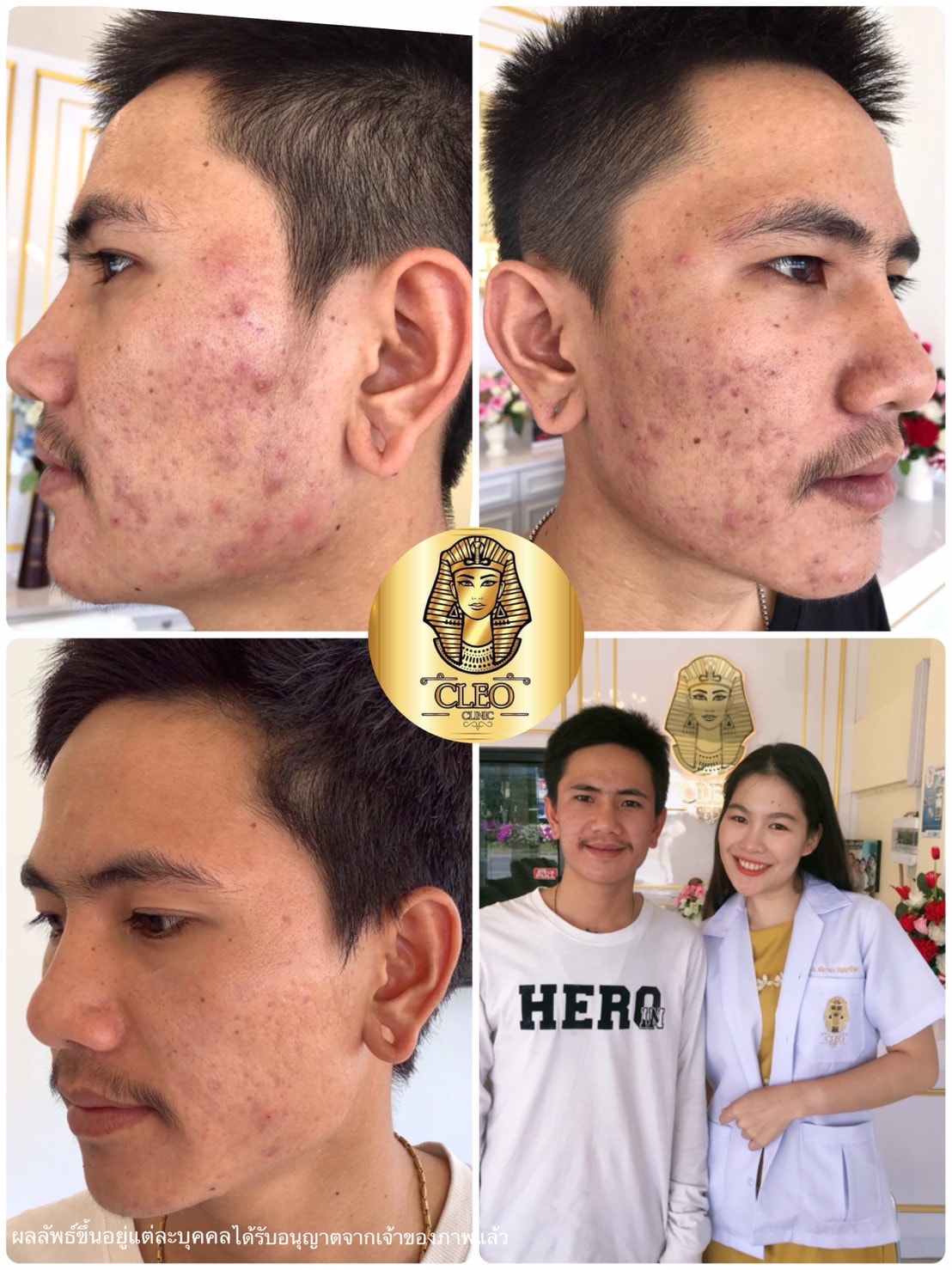 รีวิว ปี 62